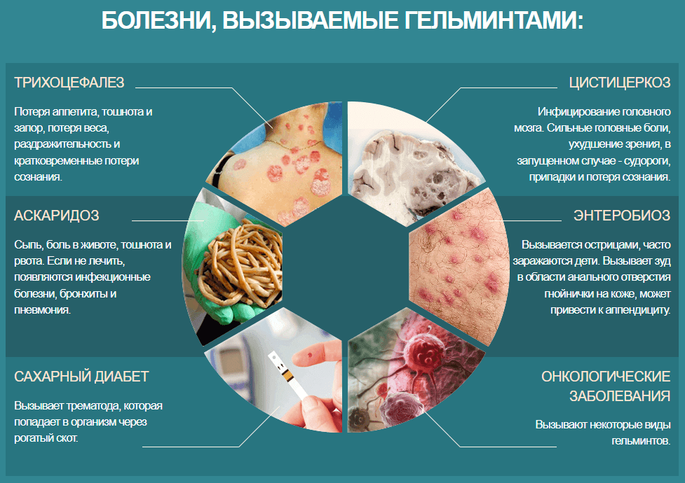 Болезни вызываемые гельминтами